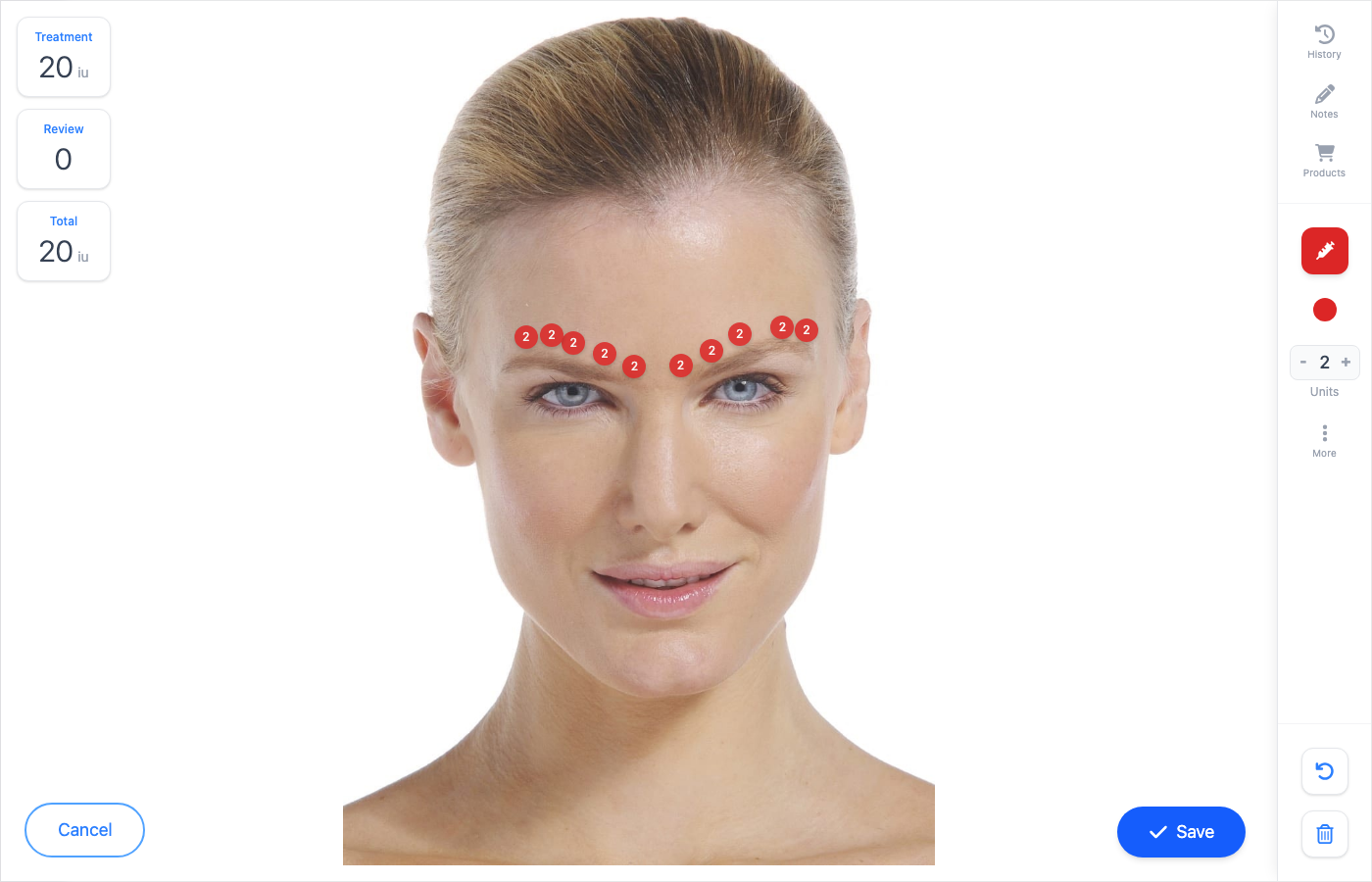 Documenti treatment map with injection points marked on the forehead